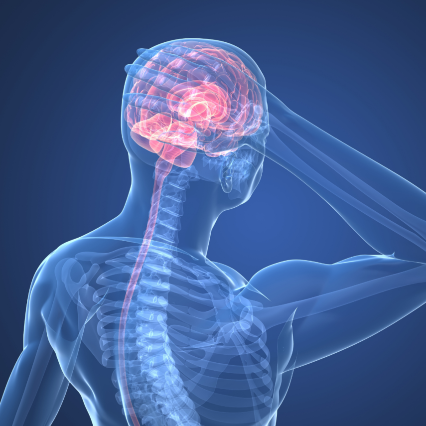 Headache Living With Superficial Siderosis