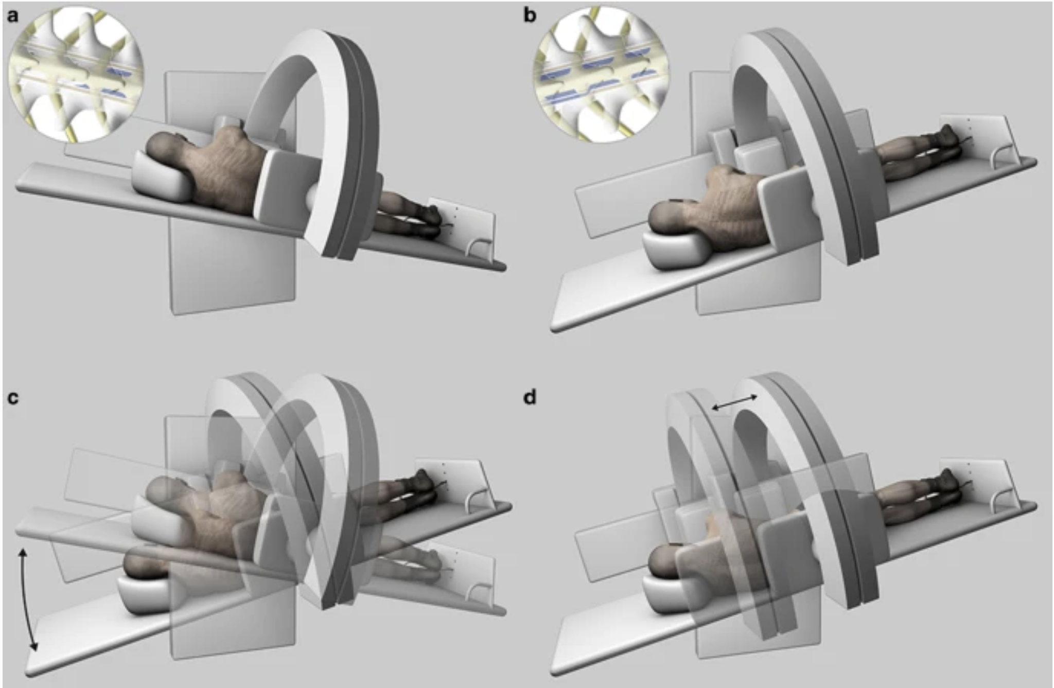 Is Digital Subtraction Myelography the Answer? | Rori Daniel
